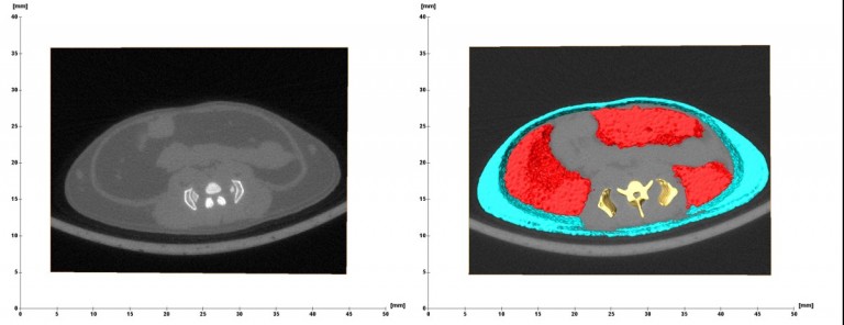 Left: A cross sectional in vivo micro-CT image of a murine visceral fat compartment and subcutaneous fat compartment Right: Visceral fat (red) and subcutaneous fat (blue) modelled in 3D allows for the visual representation and volumetric quantification of each respective compartment.